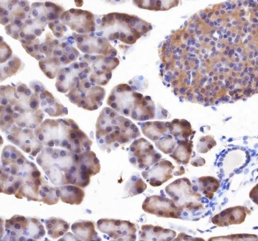 Recombinant RPL26L1 Monoclonal Antibody - small - 4