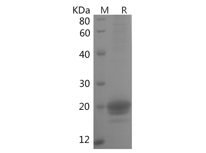 Recombinant Human IL-32α Protein(Trx Tag)-产品推荐-1
