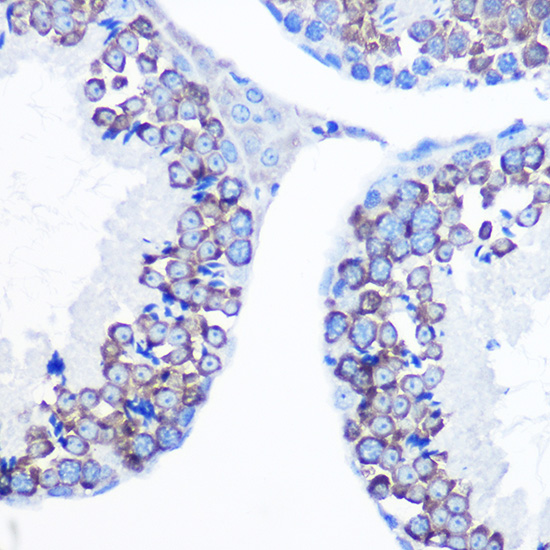 Immunohistochemistry of paraffin-embedded mouse testis using DDX4 Polyclonal Antibody at dilution of 1:100 (40x lens).Perform microwave antigen retrieval with 10 mM Tris/EDTA buffer pH 9.0 before commencing with IHC staining protocol.