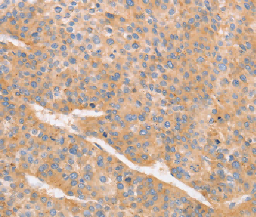 CD2AP Polyclonal Antibody - 3