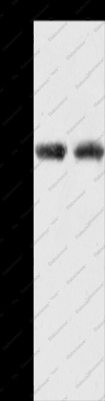 ACOT11 Polyclonal Antibody - 1