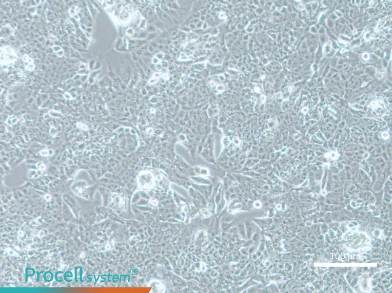 NCI-H1793NCI-H1793 - 2