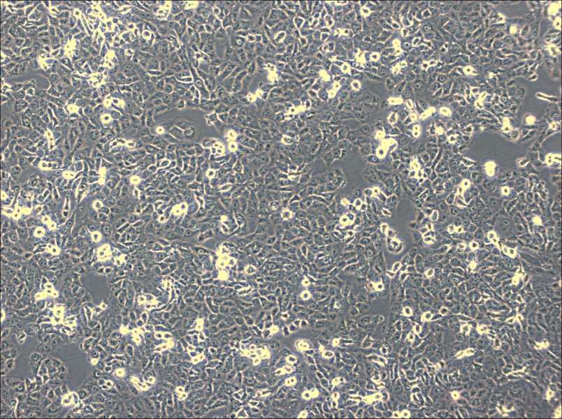 IOMM-Lee Cell Complete Medium - small - 4