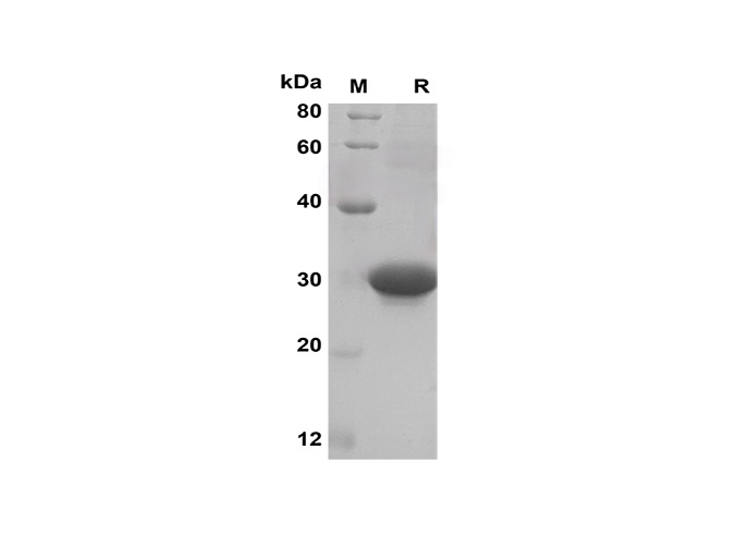 Recombinant Mouse IL-10 Protein(His Tag)-产品推荐-1