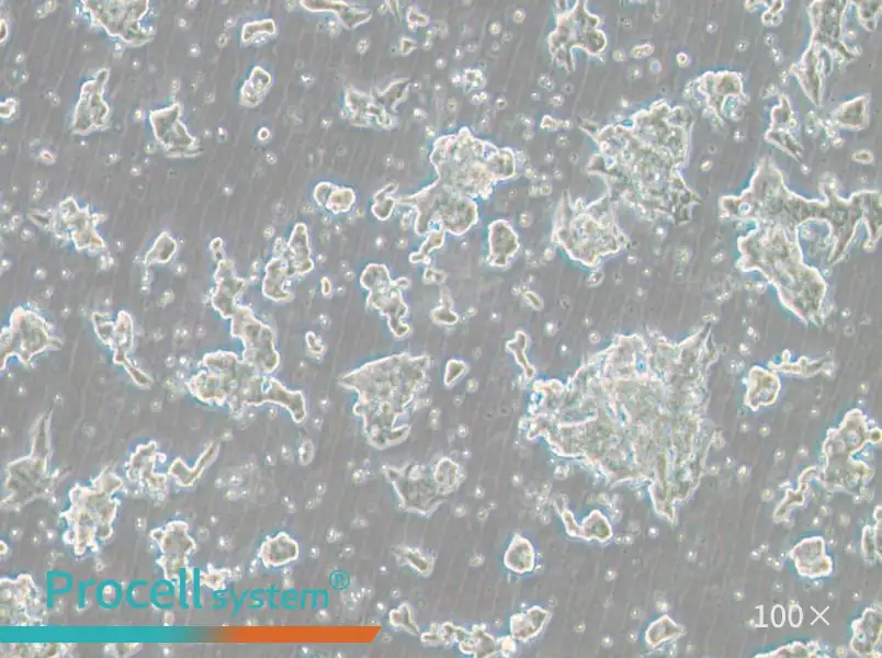 NCI-H209 [H209] Cell Complete Medium - 3