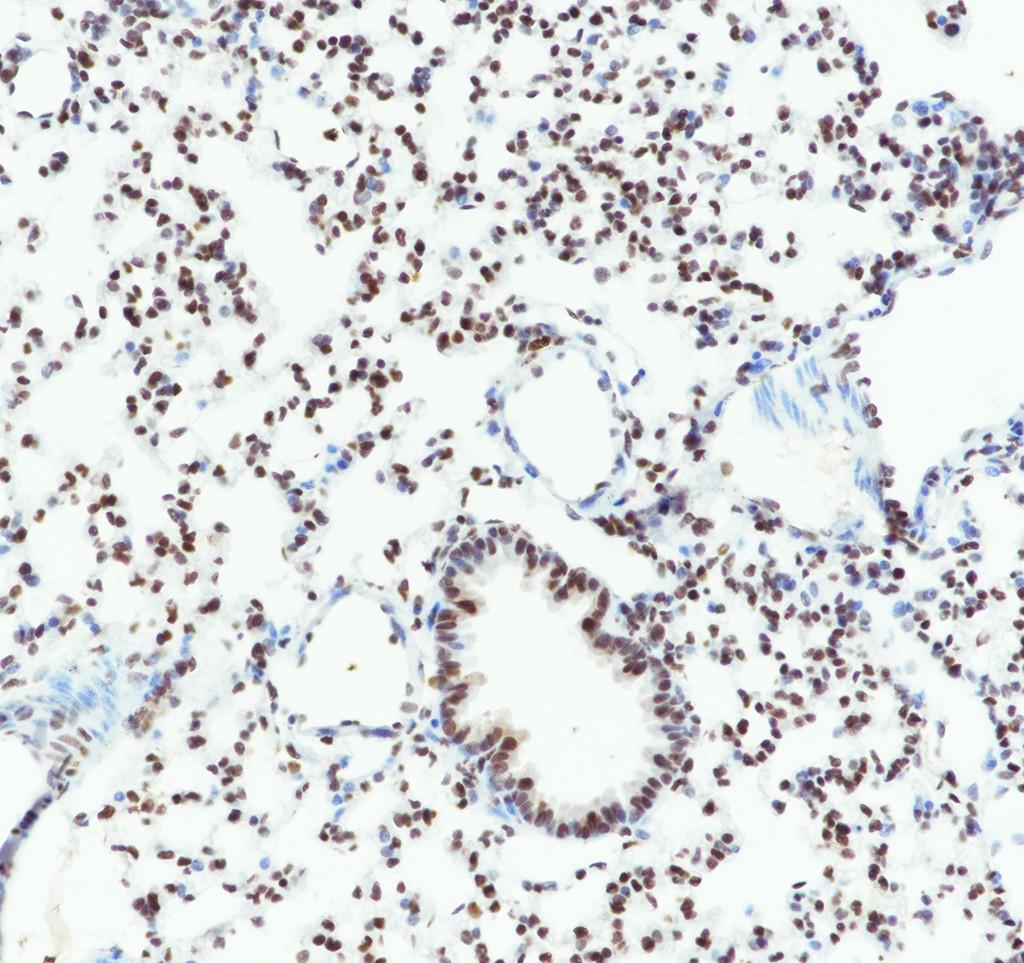 Recombinant RBBP7/RBBP4 Monoclonal Antibody - 3