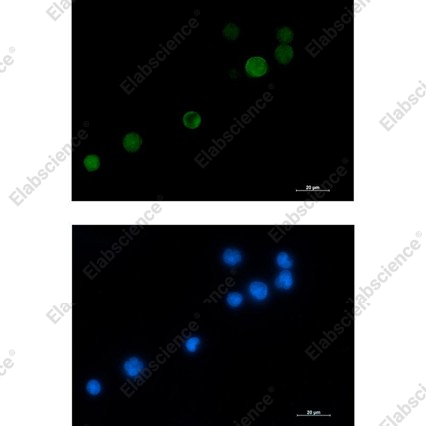 Recombinant MCAK Monoclonal Antibody - 2