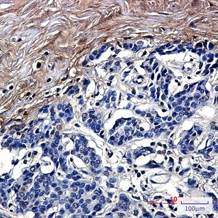 Recombinant CLEC3B/Tetranectin Monoclonal Antibody - 3