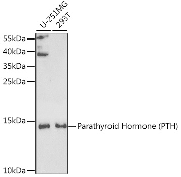 Western blot analysis of extracts of various cell lines using Parathyroid Hormone (Parathyroid Hormone (PTH)) Polyclonal Antibody at 1:1000 dilution.