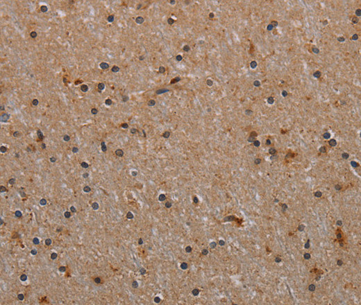 Immunohistochemistry of paraffin-embedded Human brain tissue using p70 S6 kinase beta Polyclonal Antibody at dilution 1:40