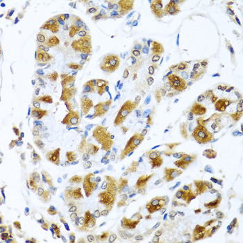 Immunohistochemistry of paraffin-embedded Human stomach using PIAS3 Polyclonal Antibody at dilution of  1:100 (40x lens).