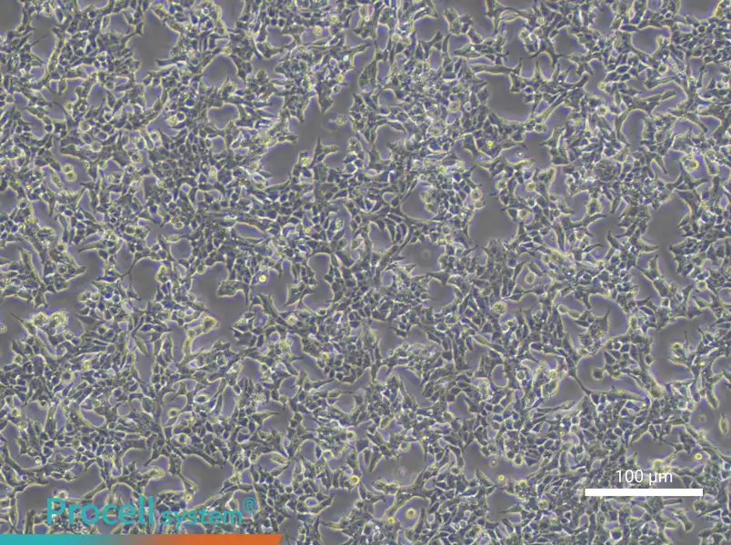 22RV1 Cell Complete Medium - 2