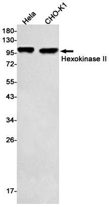 Western blot detection of Hexokinase II in Hela,CHO-K1 cell lysates using Hexokinase II Rabbit mAb(1:500 diluted).Predicted band size:102kDa.Observed band size:102kDa.