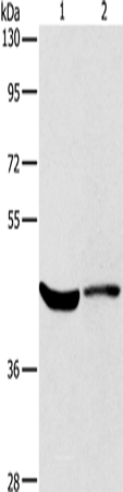 Western Blot analysis of Hela cell and Mouse kidney tissue using KCNA7 Polyclonal Antibody at dilution of 1:550