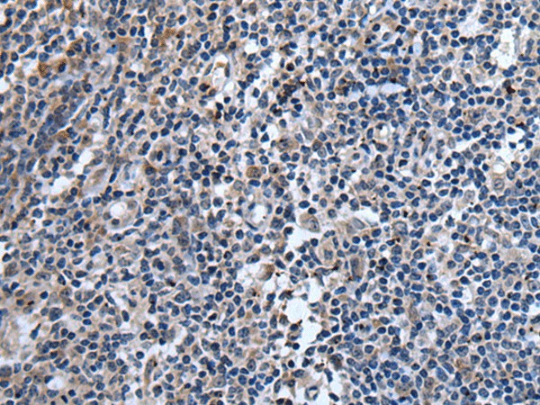 Immunohistochemistry of paraffin-embedded Human tonsil tissue  using TNFSF18 Polyclonal Antibody at dilution of 1:45(?200)