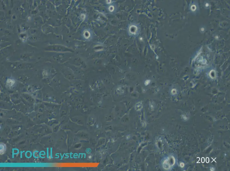 HuCC-T1 Cell Complete Medium - 4