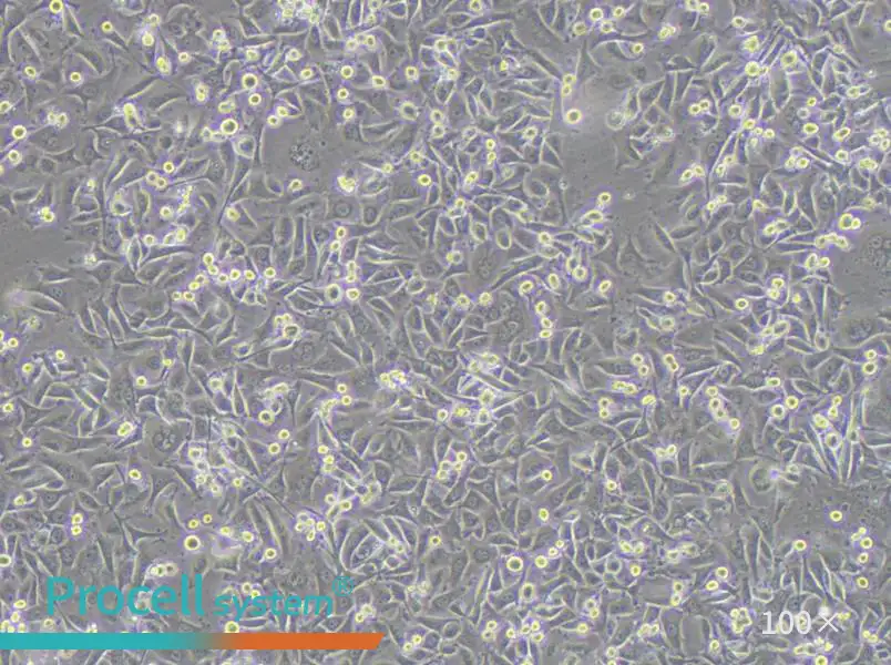 MKN1 Cell Complete Medium - 3