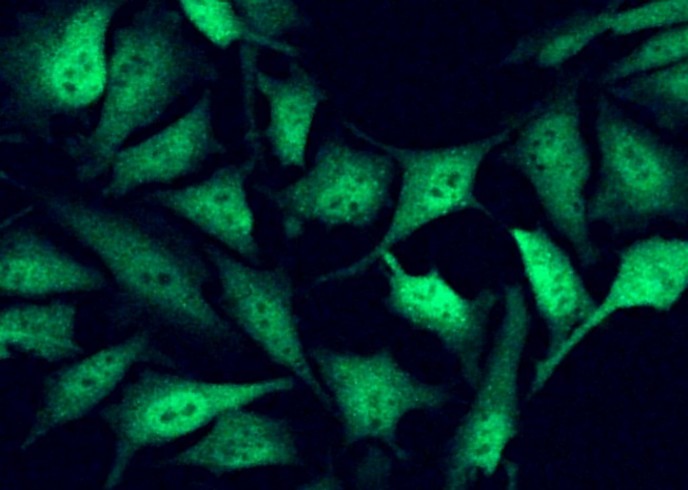 Recombinant Fragile histidine triad/FHIT Monoclonal Antibody - small - 1