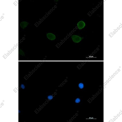 Recombinant P70 S6 Kinase beta Monoclonal Antibody - 3