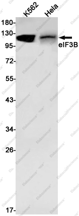 Recombinant eIF3B Monoclonal Antibody - 1