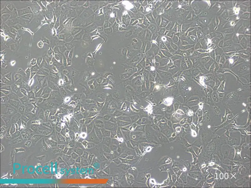 NCI-H1693 Cell Complete Medium - 1