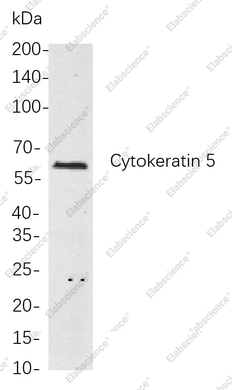 Recombinant Cytokeratin 5 Monoclonal Antibody - 1