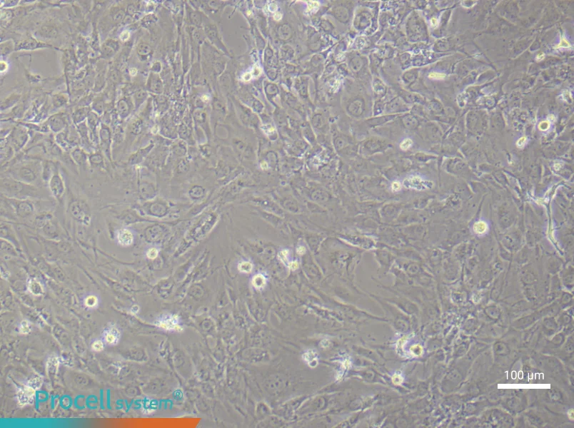 Human Synovial Fibroblast (Primary cell immortalization) Complete MediumHuman Synovial Fibroblast (Primary cell immortalization) Complete Medium - 2