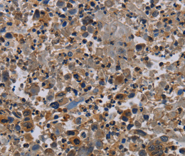 NECTIN4 Polyclonal Antibody - 3