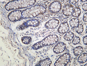 Recombinant FGF7 Monoclonal Antibody - 1