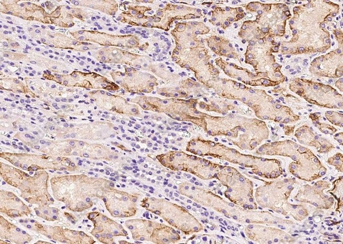 VCAM1/VCAM-1/CD106 Monoclonal Antibody - 3