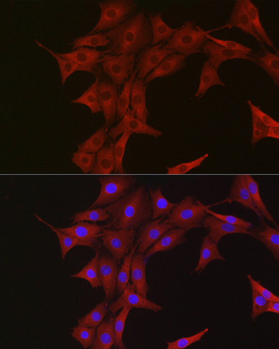 Immunofluorescence analysis of PC-12 cells using Ubiquitin Polyclonal Antibody at dilution of 1:50 (40x lens). Blue: DAPI for nuclear staining.