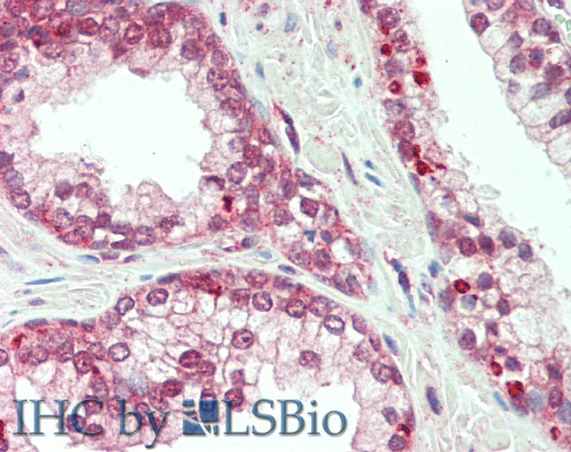 Immunohistochemistry of paraffin-embedded Prostate tissue using PLXNB1 Polyclonal Antibody at dilution of 1:60(Elabscience Product Detected by Lifespan).