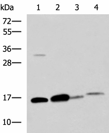 Western blot analysis of Human sigmoid tissue Mouse large intestine tissue Mouse small intestines tissue Mouse Pancreas tissue lysates  using ZG16 Polyclonal Antibody at dilution of 1:800