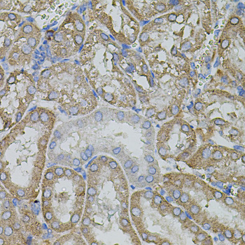 Immunohistochemistry of paraffin-embedded Mouse kidney using MMP9 Polyclonal Antibody at dilution of 1:100 (40x lens).