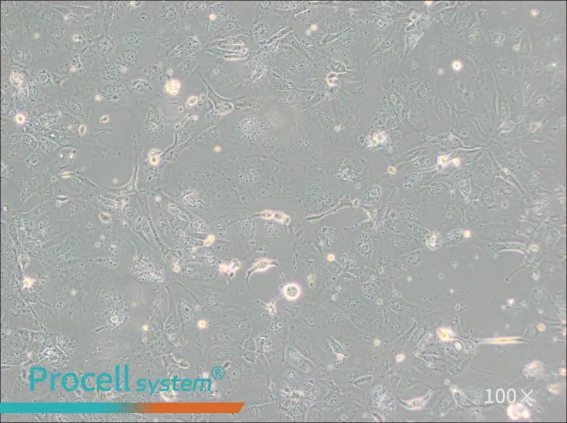 NCI-H2347 Cell Complete Medium - 1