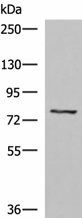 Western blot analysis of 293T cell lysate  using TGFBI Polyclonal Antibody at dilution of 1:1050