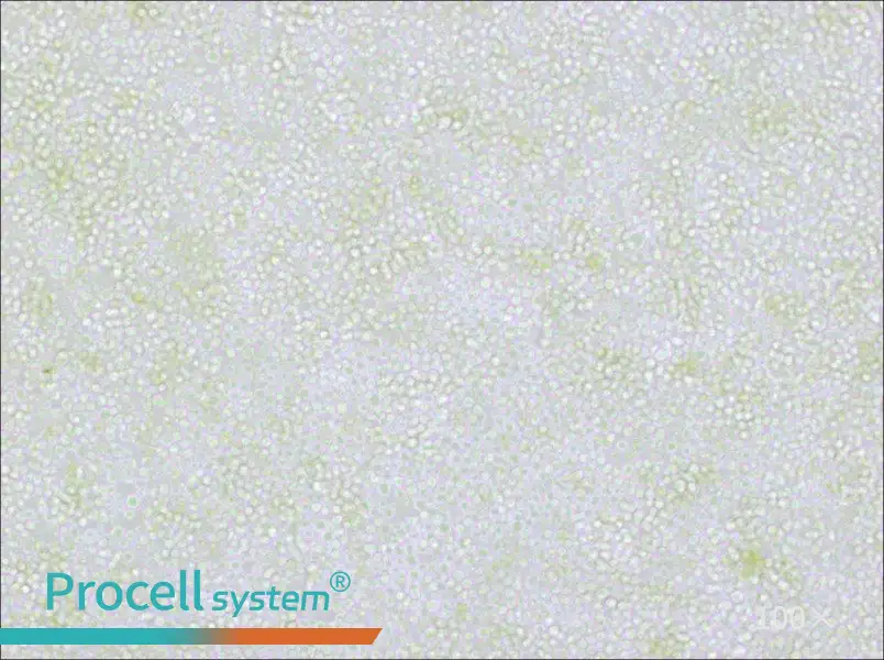 OKT 11 Cell Complete Medium - 3