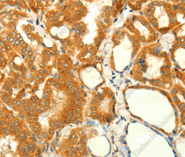 NAPA Polyclonal Antibody - 3