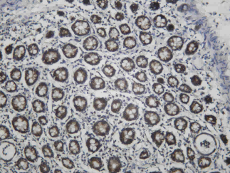 Recombinant TOMM40 Monoclonal Antibody - 1