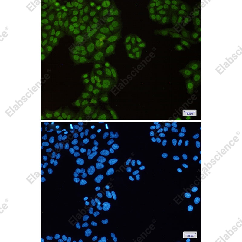 Recombinant KAP1 Monoclonal Antibody - 2