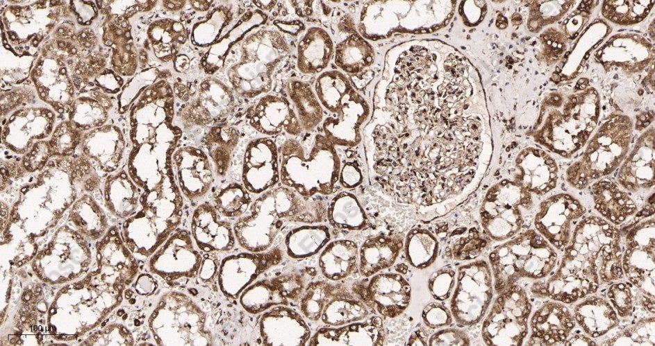 Recombinant Calreticulin Monoclonal Antibody - 2