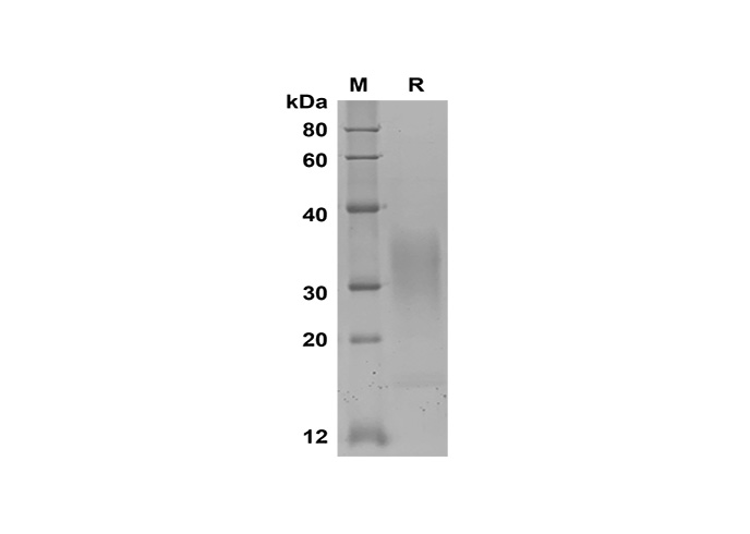 Recombinant Rat IL-5 Protein(His Tag)-产品推荐-1