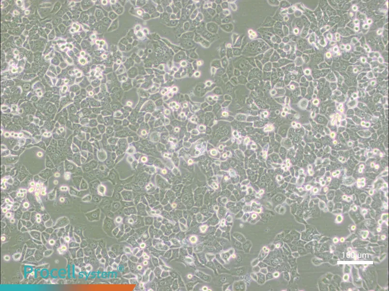 NCI-H2126NCI-H2126 - 2