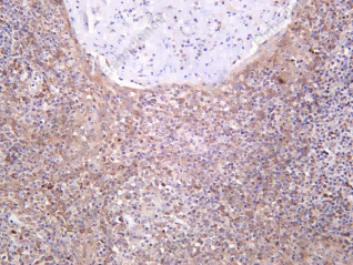 Recombinant MYT1 Monoclonal Antibody - 1