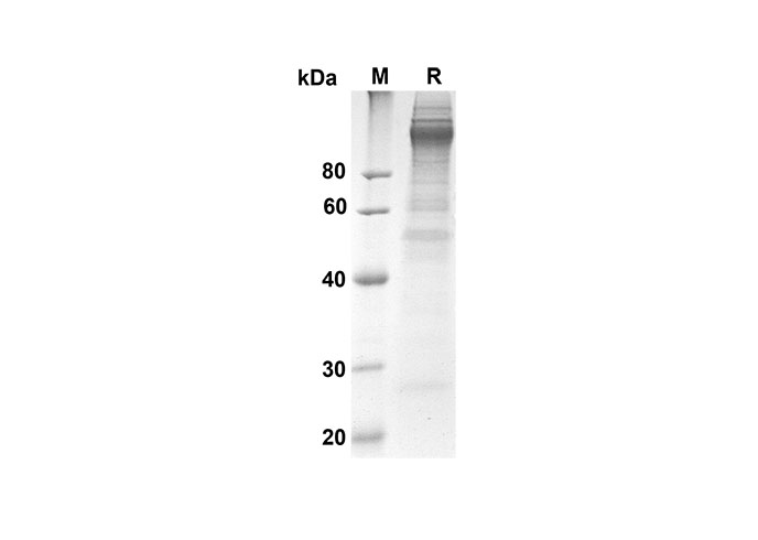Recombinant Mouse IL2 Protein (His Tag)-产品推荐-1