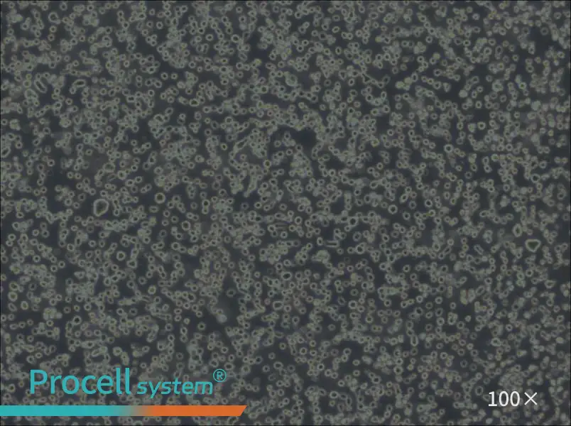 Karpas-299 Cell Complete MediumKarpas-299 Cell Complete Medium - 2