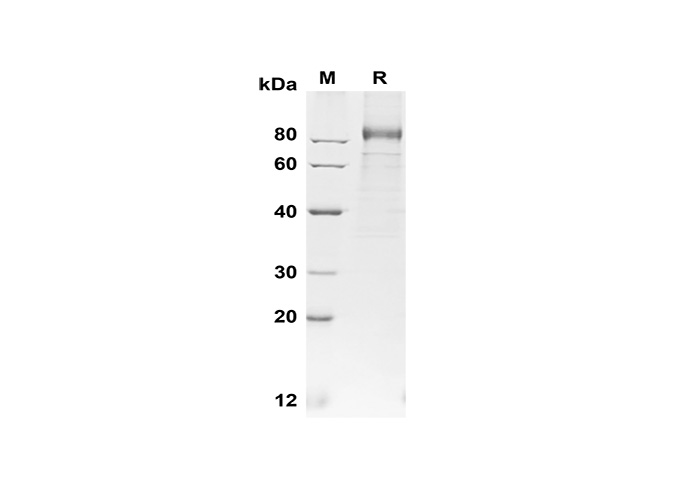 Recombinant Human IL1B Protein(His Tag)-产品推荐-1