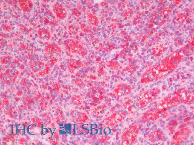 Immunohistochemistry analysis of paraffin-embedded Human Spleen using STAT1 Polyclonal Antibody(Elabscience Product Detected by Lifespan).