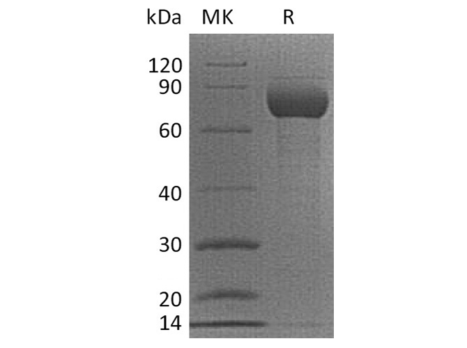 Recombinant Cynomolgus CD38/ADP-ribosyl Cyclase 1 Protein (Fc Tag)