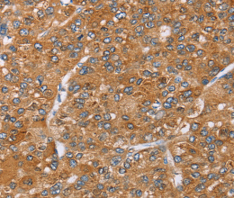 PAICS Polyclonal Antibody - 2
